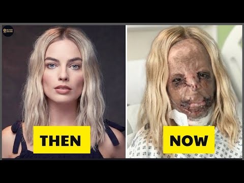 15 Celebrity Plastic Surgery Disasters That Ruined Their Looks | Then and Now 2026