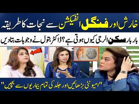 How to Heal Fungal Infections Fast? | Skin Allergy Treatment! | Dr. Batool Ashraf | Madeha Naqvi