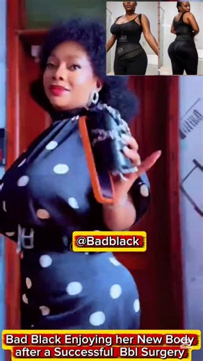 Bad Black Enjoying her New Body after a Successful Bbl Surgery