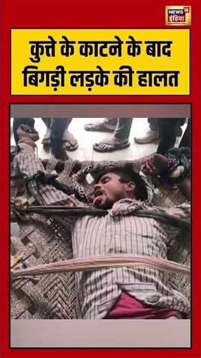 कुत्ते के काटने के बाद बिगड़ी लड़के की हालत | #viralvideo #viralnews #dogbite #shorts