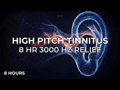 High Pitch Tinnitus Relief Sound | Stop High Ringing 3000 Hz Masker (8 Hours)
