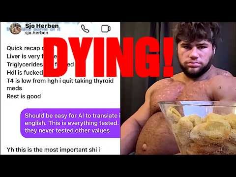 Sjo's Kidney Heart & Liver Are Failing