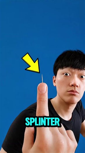 Why Pulling a Splinter the Wrong Way Could Push It Even Deeper? 😱🩹