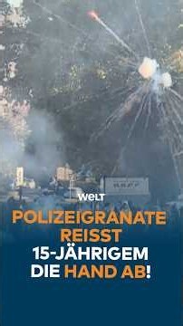 FRANKREICH: POLIZEIGRANATE REISST 15-JÄHRIGEM DIE HAND AB! SCHÜLERPROTESTE ESKALIEREN! | #shorts