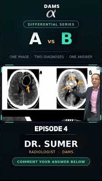 Episode 04/10 A versus B Abscess versus tumour
