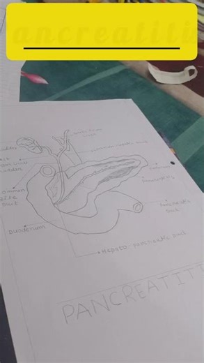 pancreatitis, anatomy of pancreas #pancreatitis#pancreas#medicalstudent #health#diagram #yt #short