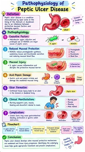 Pathophysiology of Peptic Ulcer Disease Explained | Causes & Mechanism | #shorts #gpat #pharmacy