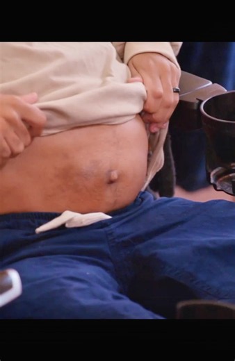 Jay & Pamela's Story: A Trans Man's Pregnancy with Chondroplasia