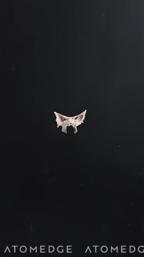 Understanding the Sphenoid Bone's Role in Skull Anatomy