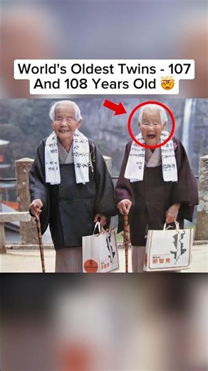 Unique Twins In The World 🤯