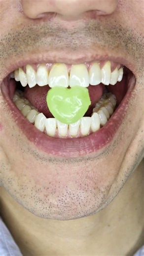 ASMR | Sumikkogurashi Heart Candy 💚 #DoctorTristanPeh #ASMR