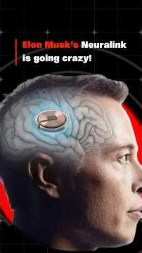 Elon Musk’s Neuralink Is INSANE 🧠🤯 | Future of Brain Chips #shorts