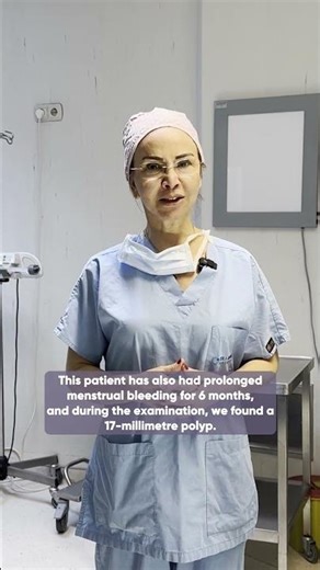 Abnormal Uterine Bleeding Caused by Endometrial Polyps