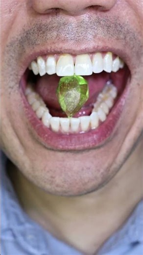 ASMR | Diamond Hard Candy #DoctorTristanPeh #ASMR