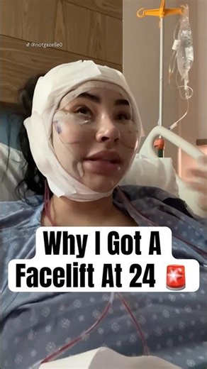 Why I Got A Facelift At 24 #shorts #facelift #plasticsurgery