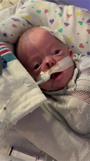 NICU Baby With Choanal Atresia | Surgery, Stents & Survival #nicujourney #newbornbaby