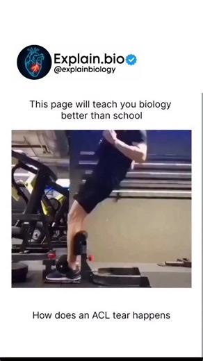 BIOLOGY | MEDICAL | HEALTH on Instagram: "Ever wondered what actually happens inside your knee during a ligament injury? In this video, we look at the mechanics of an Anterior Cruciate Ligament (ACL) tear. Using a gym fail as a real-world example, we transition into a 3D anatomical view of the femur, tibia, and fibula to show exactly how the ACL snaps under extreme tension or improper form. Understanding the relationship between your bones and ligaments is the first step in injury prevention. St