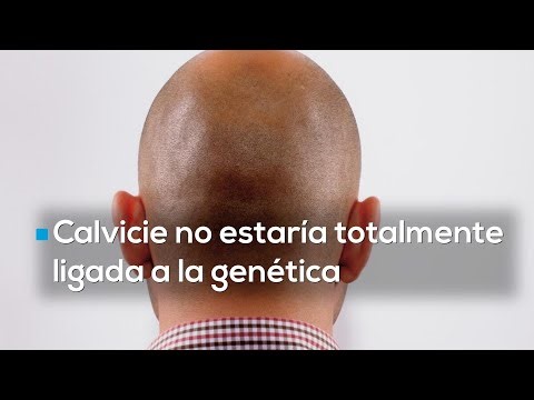 #HechosDeTi | ¿Te estás comenzando a quedar calvo? No todo se trata de la genética