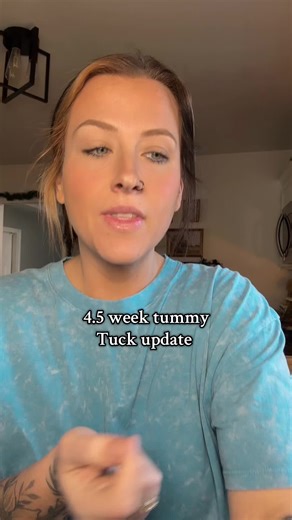 4.5 Week Abdominoplasty Recovery Update