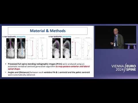 Radiomics-Powered Radiographic Image Analysis for Enhanced Mechanical Com | Pellisé | EUROSPINE 2024