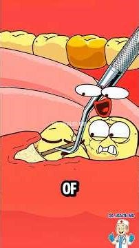 Why Dentists Won't Pull All 4 Teeth at Once! #wisdom #shorts