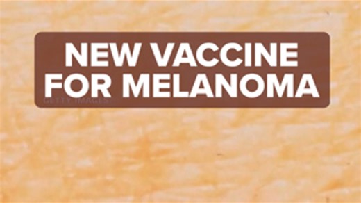 New vaccine for melanoma