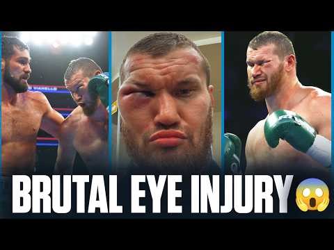 Arslanbek Makhmudov vs Guido Vianello | FULL FIGHT