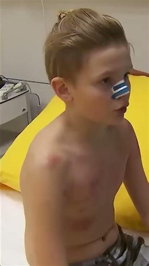 Warum hat das Kind so viele blaue Flecke? #gefahr #verletzung #krankenhaus