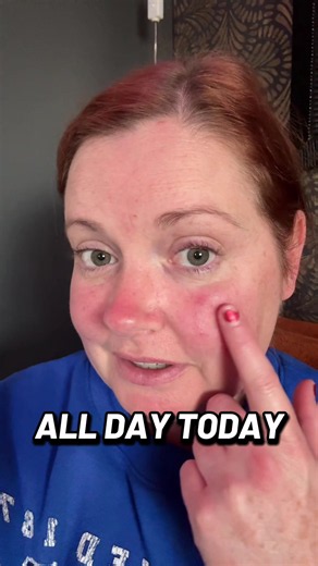 The joys of being a mortician with MCAS. #mortician #funeraldiretor #embalmer #morticiansoftiktok #mcas