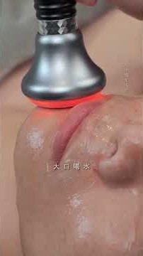 You Won’t Believe This Amazing Blackhead Removal Transformation! 😱✨