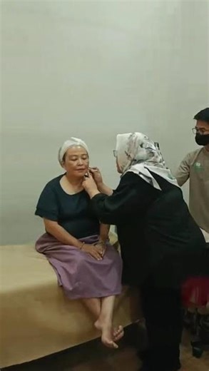 TBTC PLLA 400 used for face #dermalfillers #plla