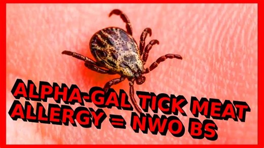 War on Meat : Alpha-Gal-Syndrome