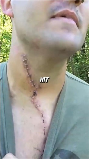 50 Cal Accident