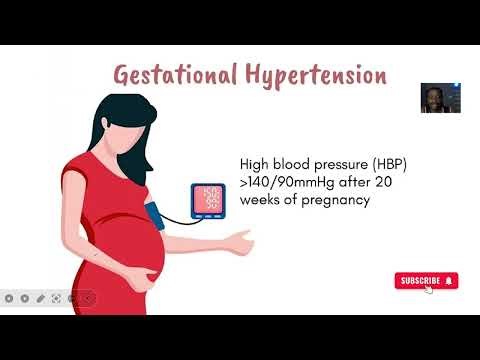 Gestational hypertension; new onset high blood pressure after 20 weeks of gestation