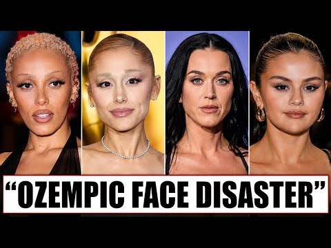 14 Female Celebrity Musicians That Suffer From “Ozempic Face” In 2026!