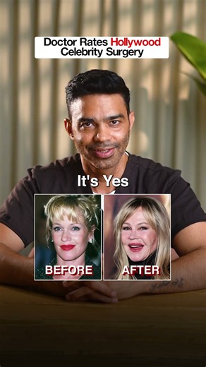 2 Hollywood Celebrities and Plastic Surgery: YES or NO?
