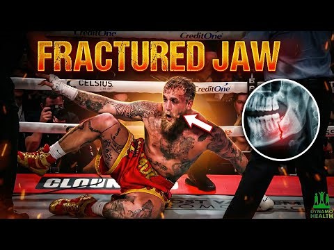 The Jake Paul Era Ends With a Broken Jaw | Doctor Explains