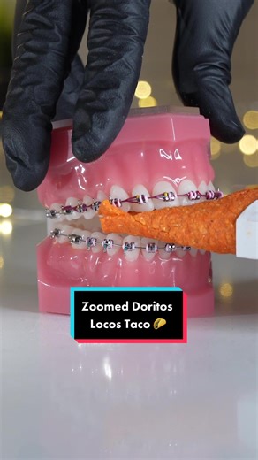Doritos Locos Tacos: Braces-Friendly Alternatives and Recipes
