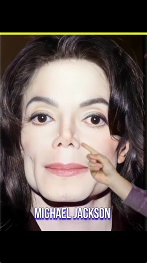 How Did Michael Jackson Become White? 😱