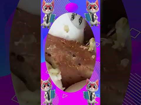 Blackheads Removal #392 | Acne Treatment and Very Satisfying Satisfying Pimple pop #blackheads