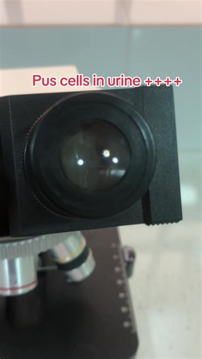 Urinary Tract Infection Explained