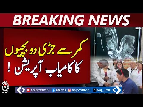 Conjoined Twins Surgery | Two Girls Separated in Peru | Medical Breakthrough - Aaj Pakistan News