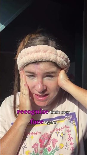 I never thought skin cancer would change the face I’d known my entire life
