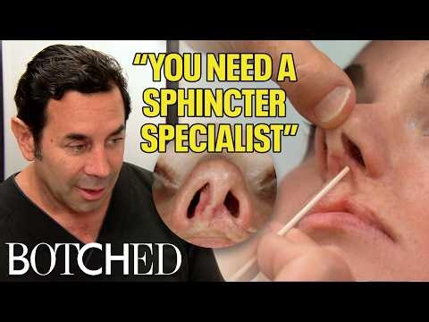 Liberty Can't Breathe After A Botched Cleft Lip and Nose Repair (Before & After) | Botched | E!