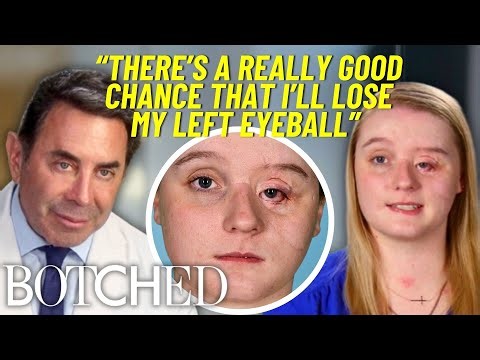 Haylie’s Left Eye Has Been Open for 8 YEARS After Surviving A Near-Fatal Car Crash | Botched | E!