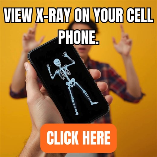 Discover images with an X-ray style 📱🦴 A curious visual to explore. | Infinity Systems