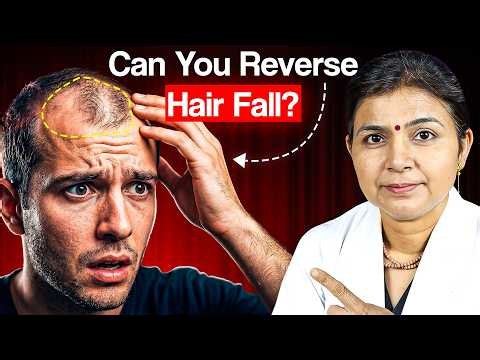 Reality of Male Pattern Baldness 😵 Can It Be Reversed?