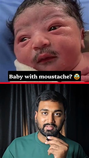 How this baby born with moustache? reality of video