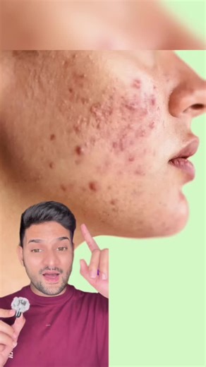 Daily Facewash for Oily Skin: Triac Facewash & SC Sunscreen