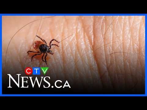 There’s a tick-borne disease on the rise that’s even worse than Lyme